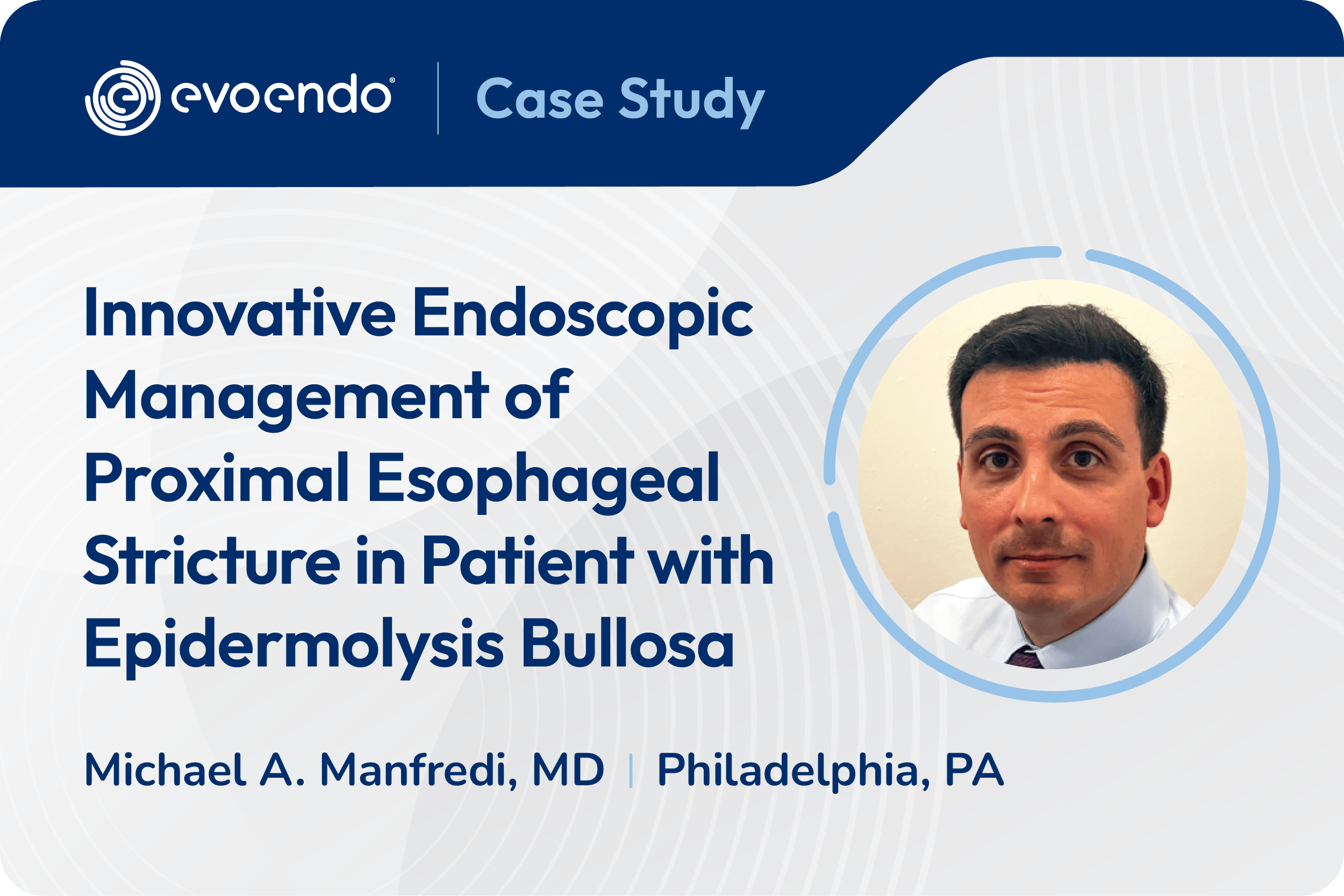 Innovative Endoscopic Management of Proximal Esophageal Stricture